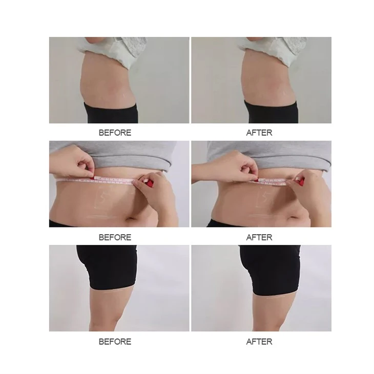 non invasive body sculpting machine (3)